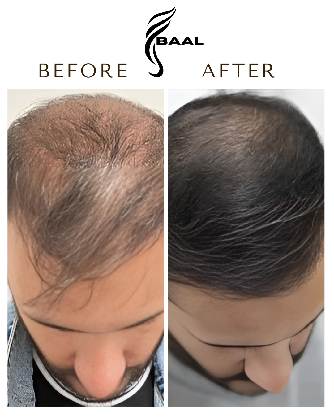 Baal Hair Oil