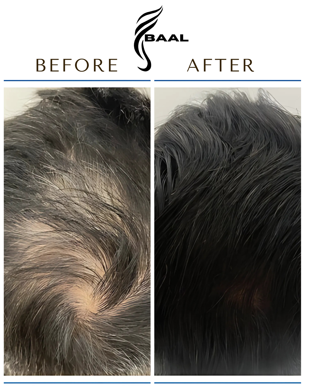Baal Hair Oil