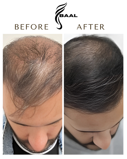 Baal Hair Oil