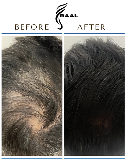 Baal Hair Oil
